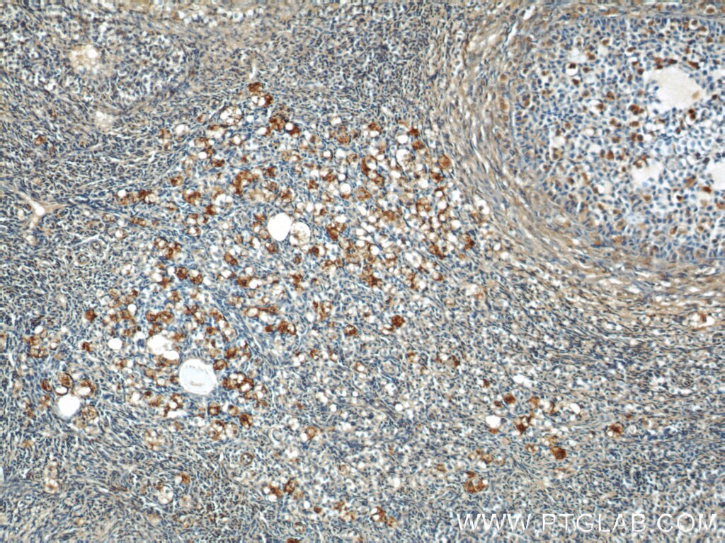 IHC staining of human ovary using 17950-1-AP