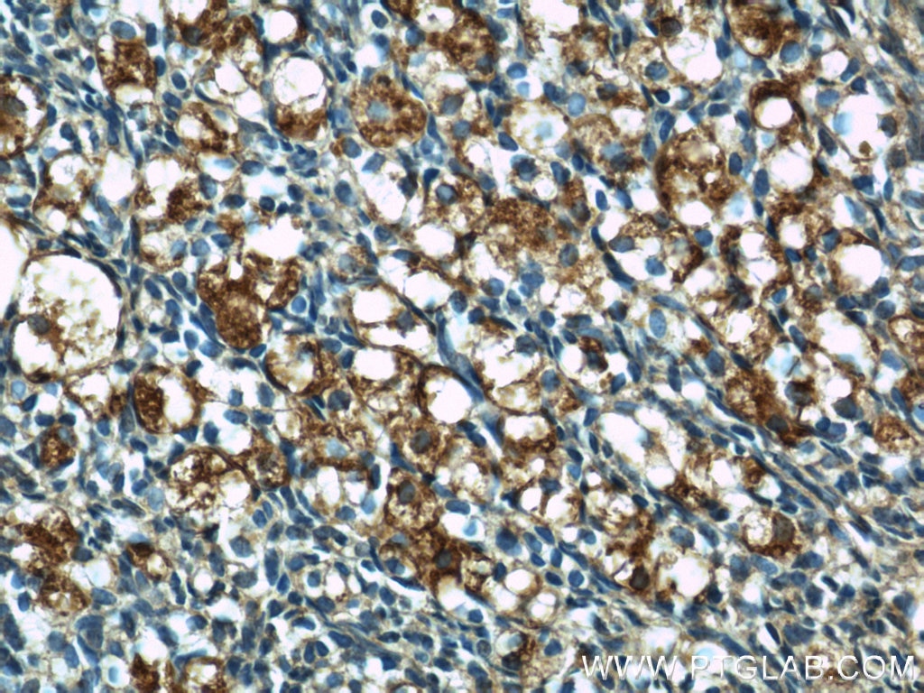 IHC staining of human ovary using 17950-1-AP