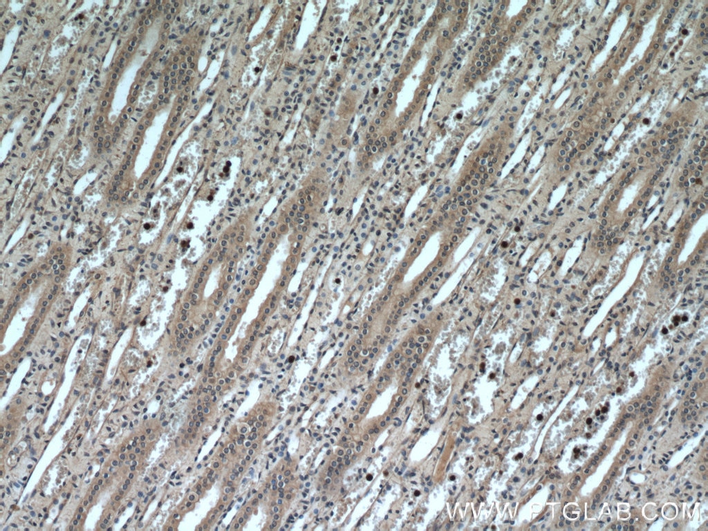 Immunohistochemistry (IHC) staining of human kidney tissue using GPR177 Polyclonal antibody (17950-1-AP)