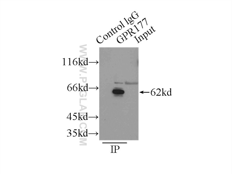 Immunoprecipitation (IP) experiment of mouse liver tissue using GPR177 Polyclonal antibody (17950-1-AP)
