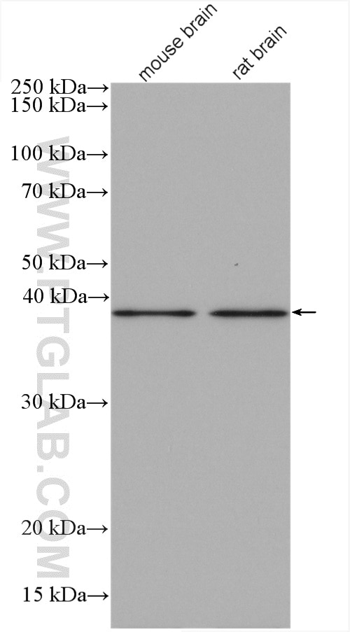 Western Blot (WB) analysis of various lysates using GPR177 Polyclonal antibody (17950-1-AP)