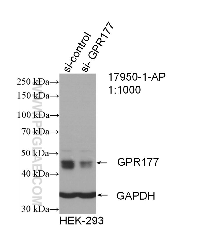 Western Blot (WB) analysis of HEK-293 cells using GPR177 Polyclonal antibody (17950-1-AP)