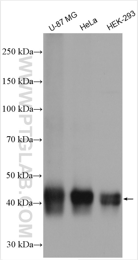 Western Blot (WB) analysis of various lysates using GPR177 Polyclonal antibody (17950-1-AP)