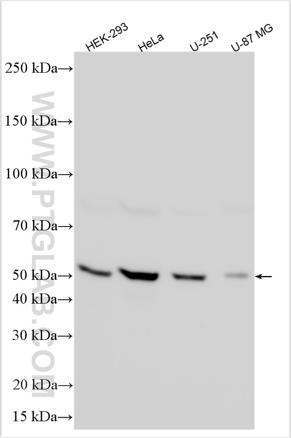 Western Blot (WB) analysis of various lysates using GPR177 Polyclonal antibody (17950-1-AP)