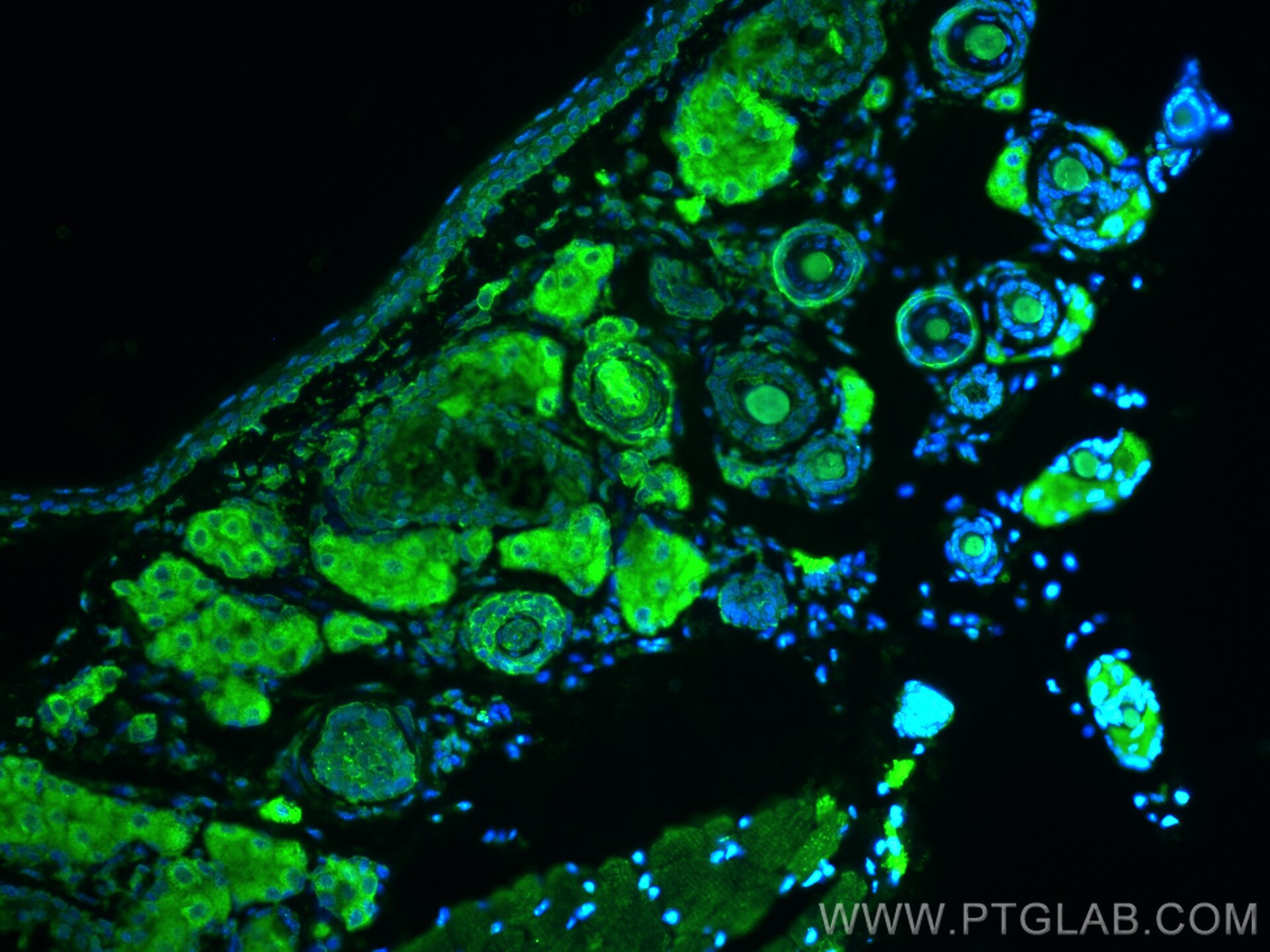 Immunofluorescence (IF) / fluorescent staining of mouse eye tissue using GPR179 Polyclonal antibody (29934-1-AP)