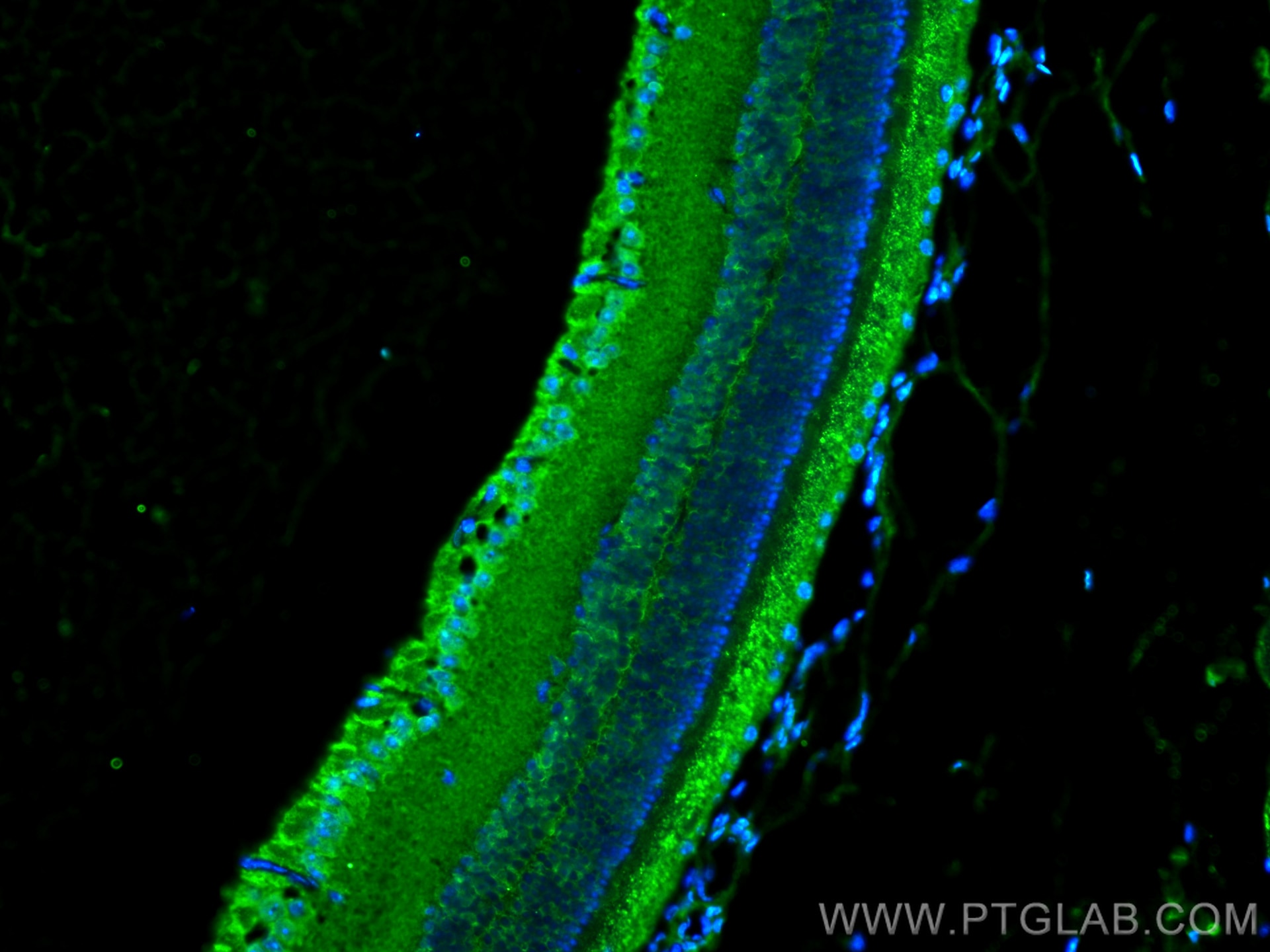 Immunofluorescence (IF) / fluorescent staining of mouse eye tissue using GPR179 Polyclonal antibody (29934-1-AP)