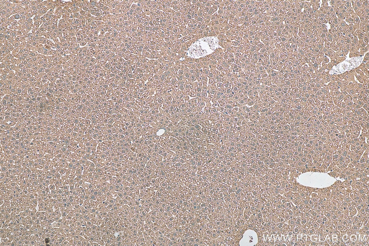 IHC staining of mouse liver using 29934-1-AP