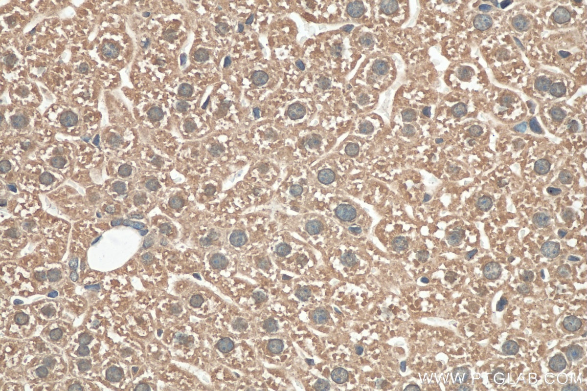 Immunohistochemistry (IHC) staining of mouse liver tissue using GPR179 Polyclonal antibody (29934-1-AP)