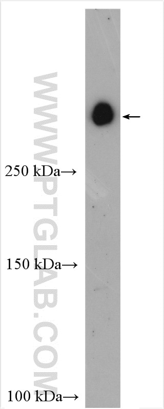 Western Blot (WB) analysis of various lysates using GPR179 Polyclonal antibody (29934-1-AP)