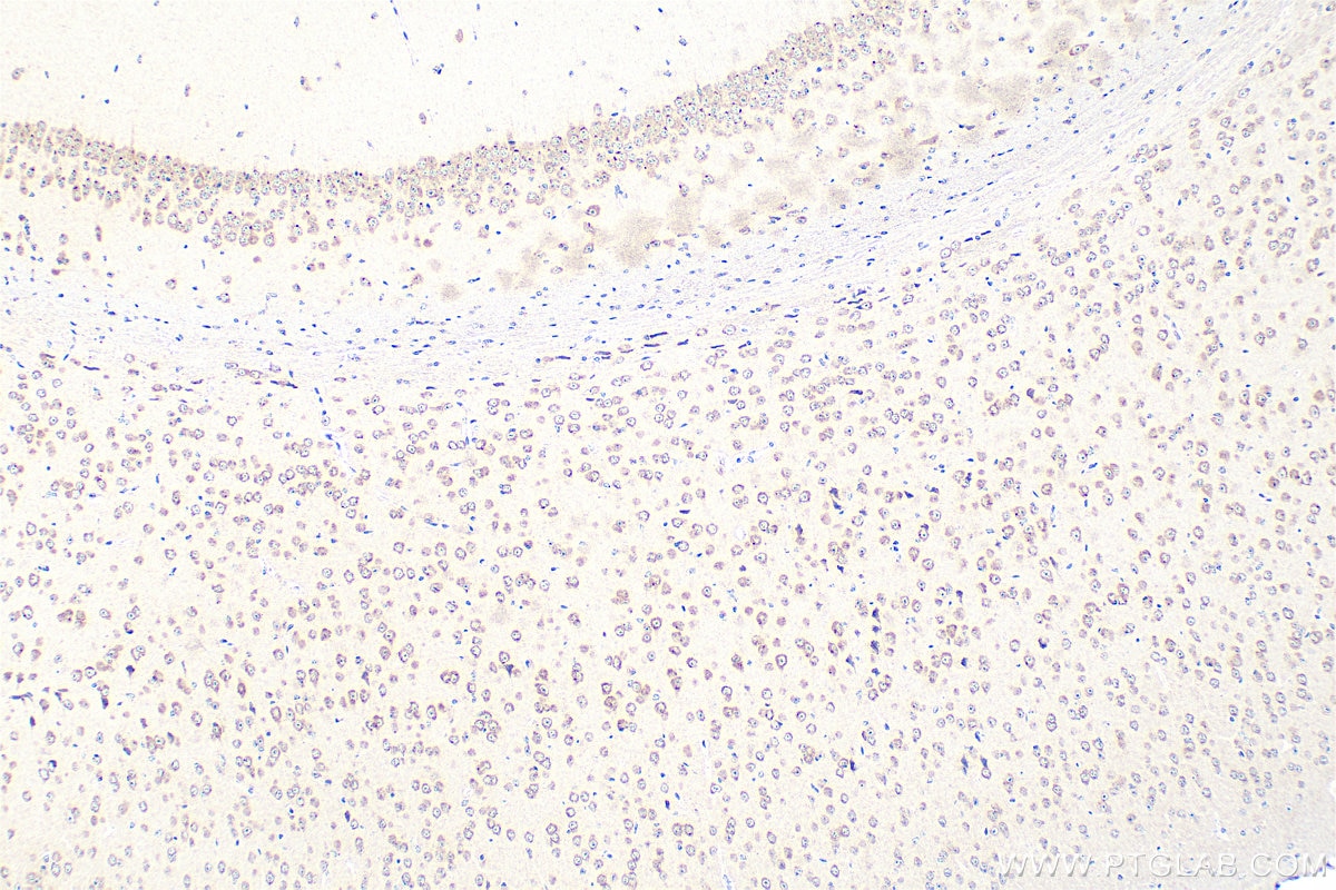 Immunohistochemistry (IHC) staining of mouse brain tissue using GPR183/EBI2 Polyclonal antibody (12377-1-AP)