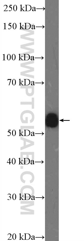 Western Blot (WB) analysis of Jurkat cells using GPR183/EBI2 Polyclonal antibody (12377-1-AP)