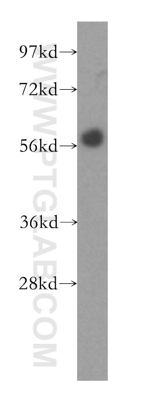 WB analysis of HeLa using 12377-1-AP