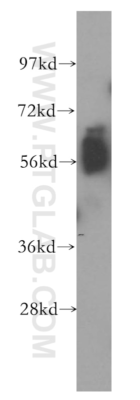 GPR183/EBI2