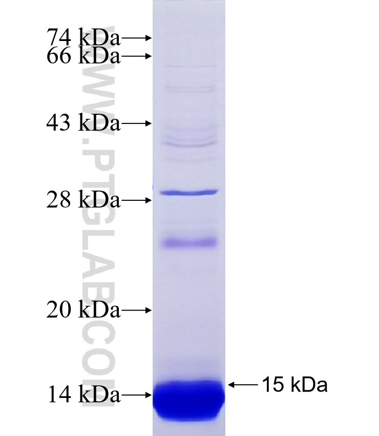 GPR183 fusion protein Ag37619 SDS-PAGE GPR183 fusion protein Ag37619 SDS-PAGE