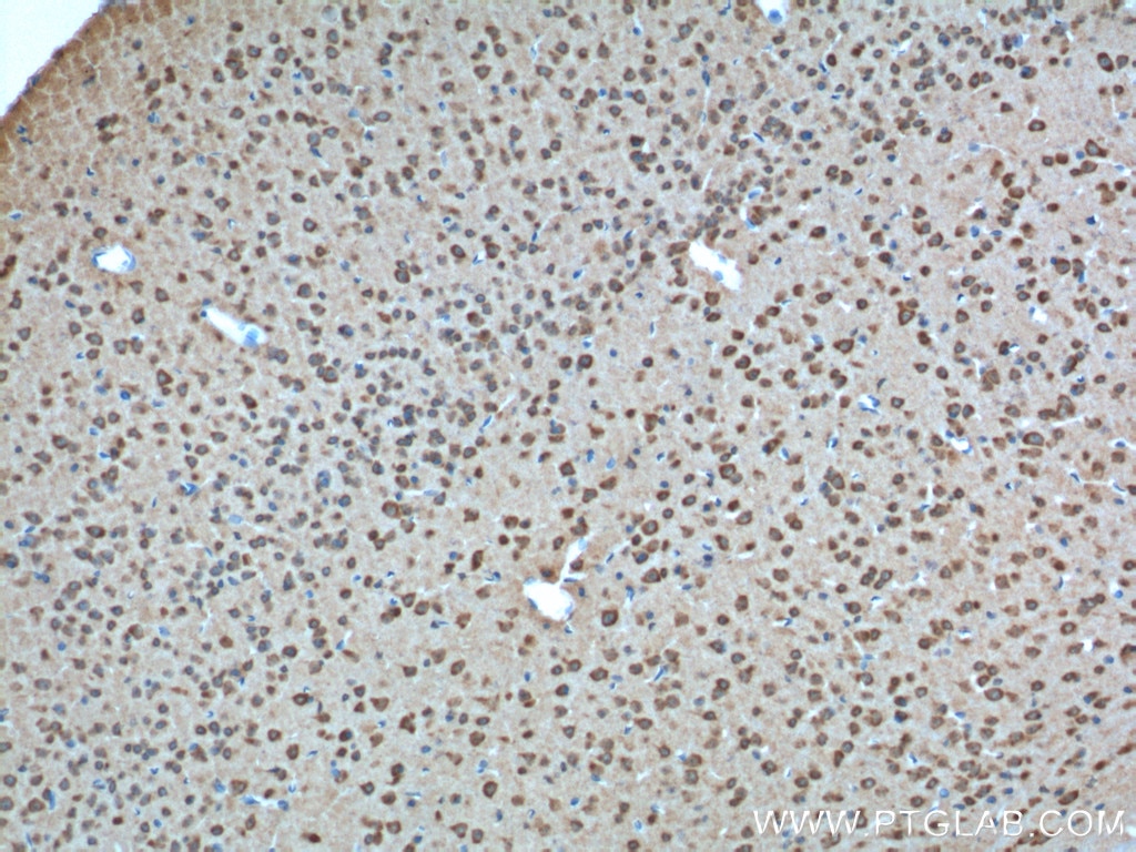 Immunohistochemistry (IHC) staining of mouse brain tissue using GPR19 Polyclonal antibody (24481-1-AP)