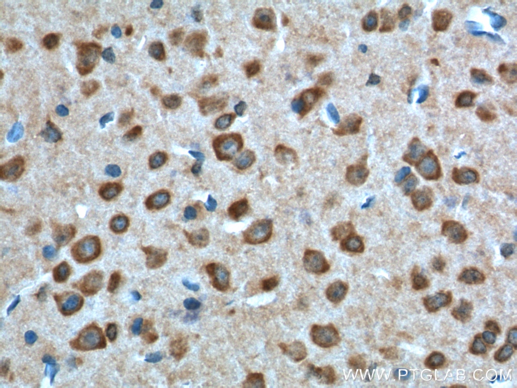 Immunohistochemistry (IHC) staining of mouse brain tissue using GPR19 Polyclonal antibody (24481-1-AP)