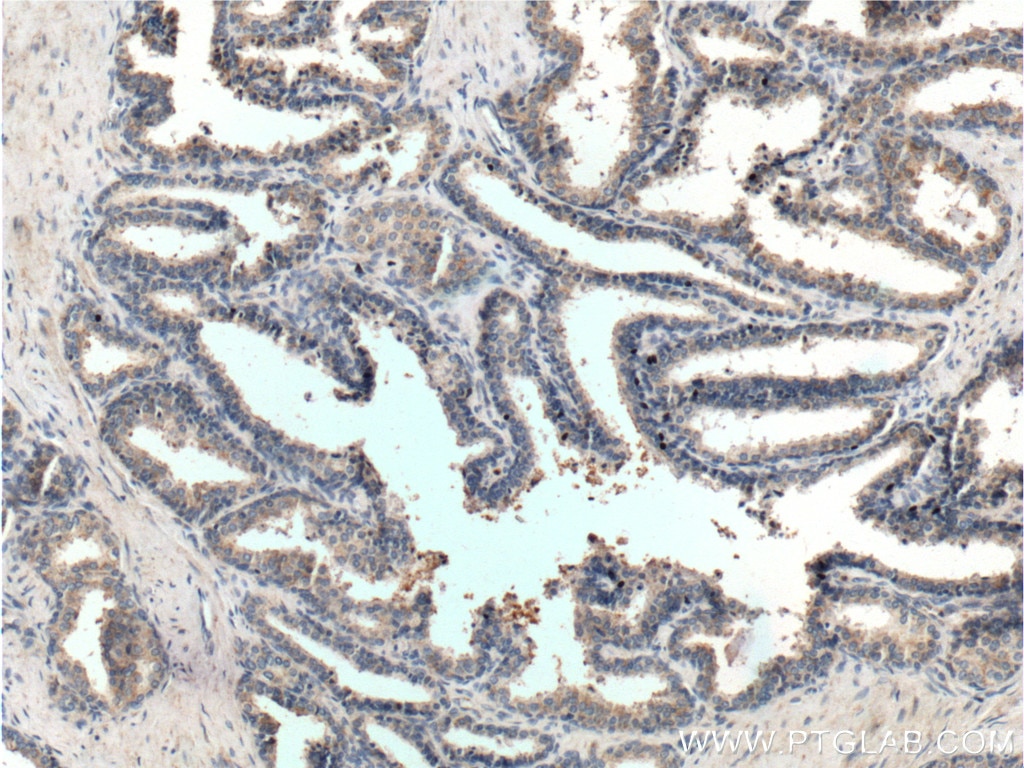 Immunohistochemistry (IHC) staining of human prostate hyperplasia tissue using GPR21 Polyclonal antibody (17973-1-AP)