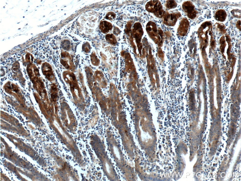 Immunohistochemistry (IHC) staining of human stomach tissue using GPR21 Polyclonal antibody (17973-1-AP)