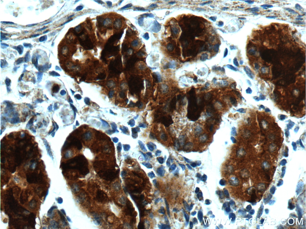 Immunohistochemistry (IHC) staining of human stomach tissue using GPR21 Polyclonal antibody (17973-1-AP)