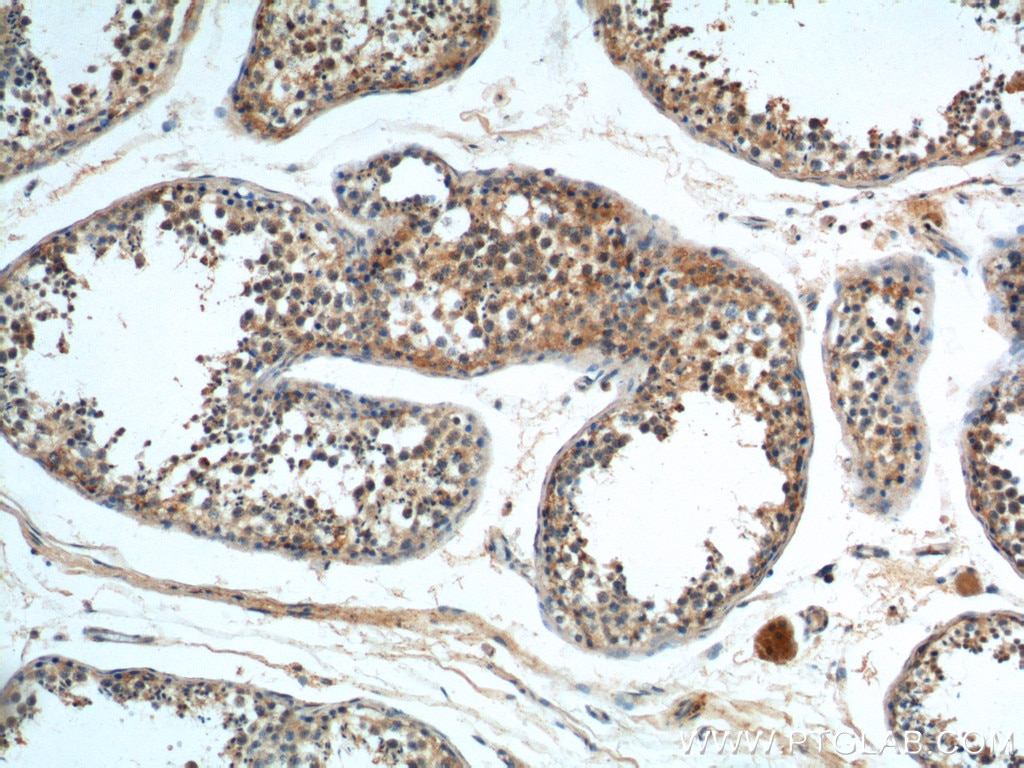 IHC staining of human testis using 19951-1-AP