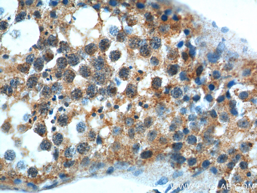 Immunohistochemistry (IHC) staining of human testis tissue using GPR22 Polyclonal antibody (19951-1-AP)