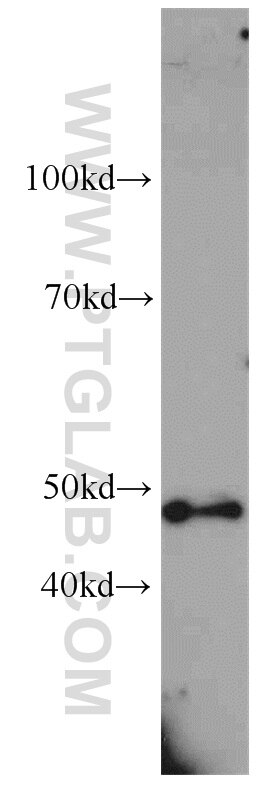 Western Blot (WB) analysis of rat brain tissue using GPR22 Polyclonal antibody (19951-1-AP)