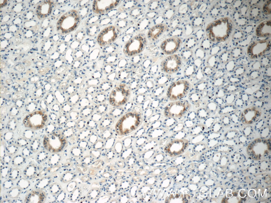 IHC staining of human kidney using 20847-1-AP
