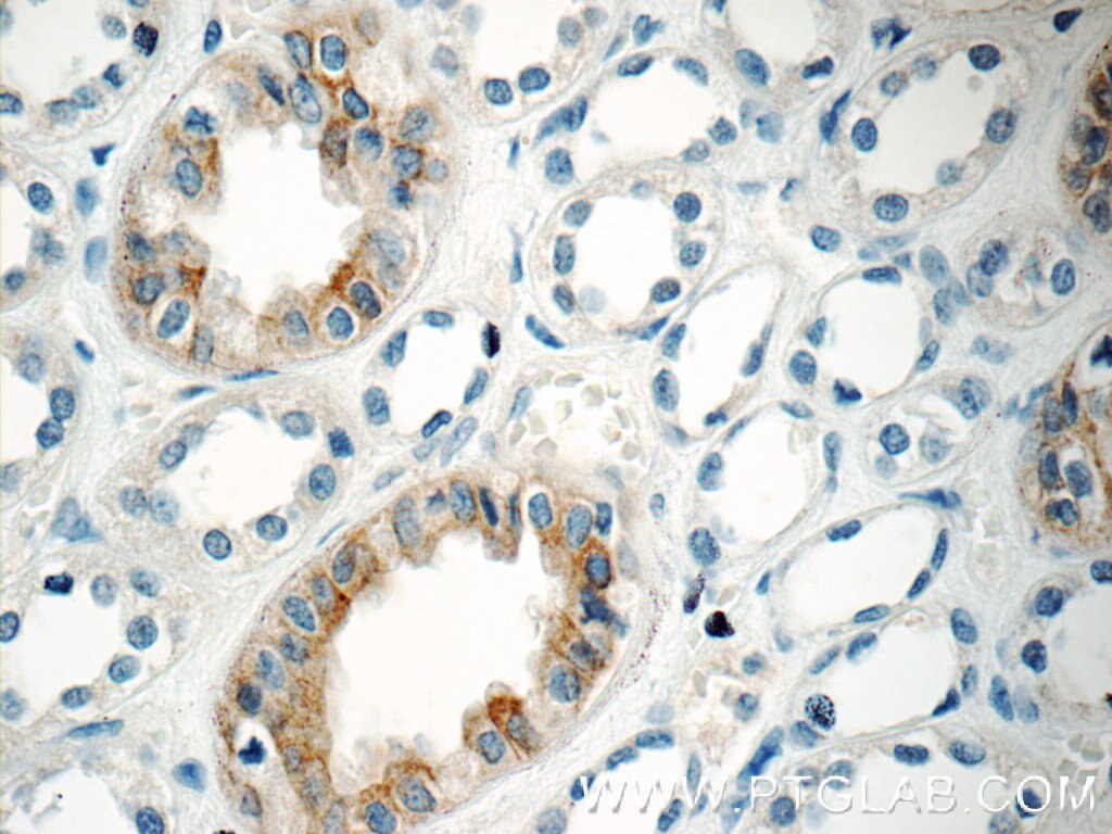 Immunohistochemistry (IHC) staining of human kidney tissue using GPR3 Polyclonal antibody (20847-1-AP)