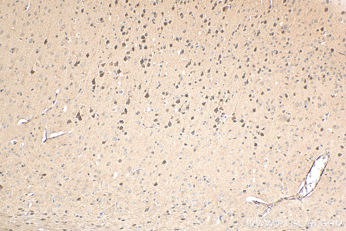 Immunohistochemistry (IHC) staining of mouse brain tissue using GPR3 Polyclonal antibody (20847-1-AP)