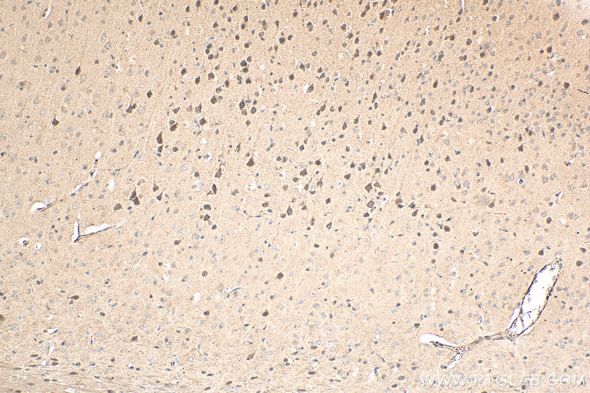 Immunohistochemistry (IHC) staining of mouse brain tissue using GPR3 Polyclonal antibody (20847-1-AP)