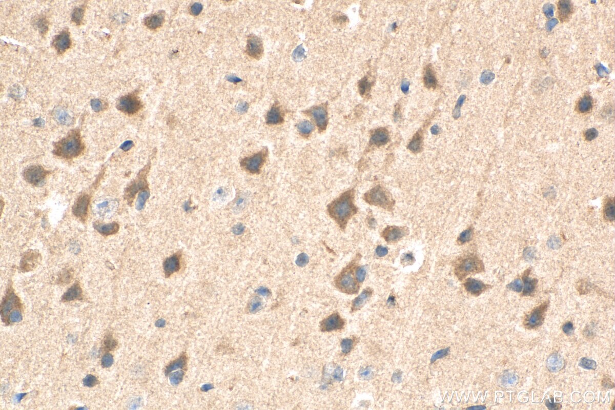 Immunohistochemistry (IHC) staining of mouse brain tissue using GPR3 Polyclonal antibody (20847-1-AP)
