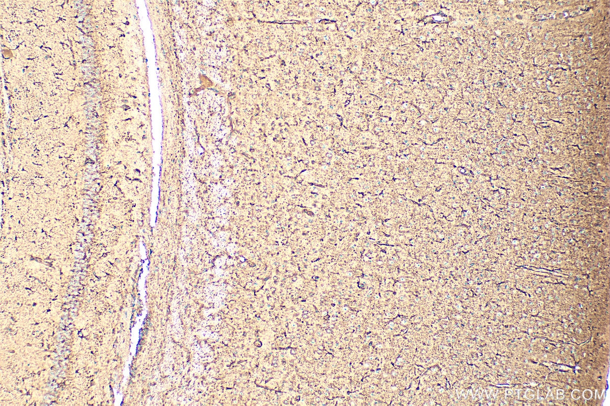 Immunohistochemistry (IHC) staining of mouse brain tissue using GPR34 Polyclonal antibody (22149-1-AP)