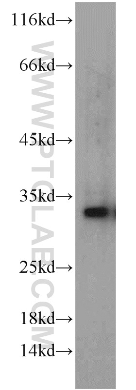 Western Blot (WB) analysis of A549 cells using GPR35 Polyclonal antibody (55248-1-AP)