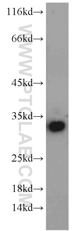Western Blot (WB) analysis of A549 cells using GPR35 Polyclonal antibody (55248-1-AP)