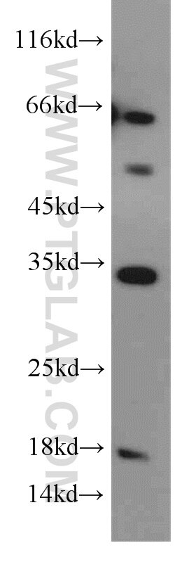 Western Blot (WB) analysis of human brain tissue using GPR35 Polyclonal antibody (55248-1-AP)