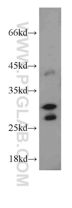 Western Blot (WB) analysis of human stomach tissue using GPR35 Polyclonal antibody (55248-1-AP)