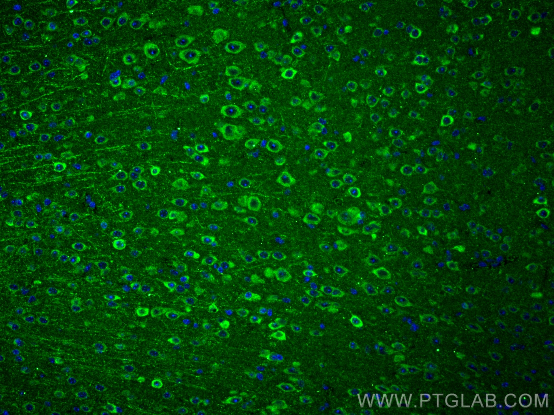 IF Staining of mouse brain using 14820-1-AP