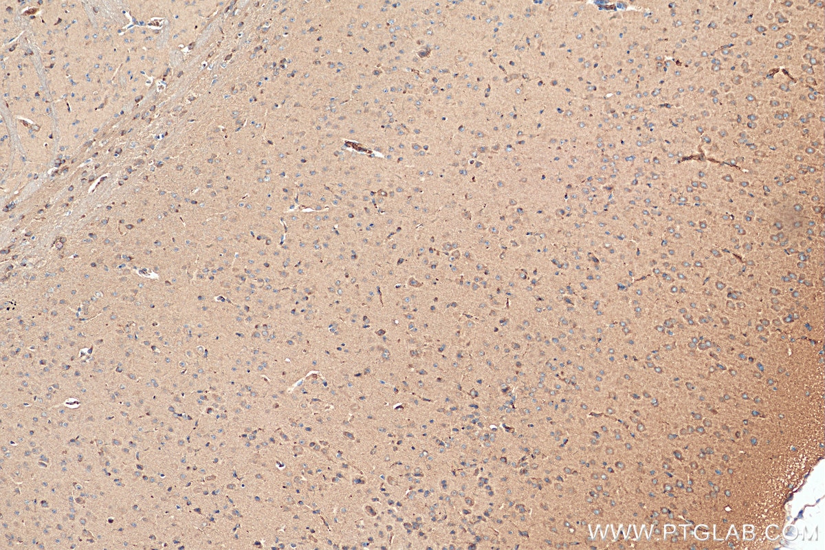 Immunohistochemistry (IHC) staining of mouse brain tissue using GPR37/Pael-R Polyclonal antibody (14820-1-AP)