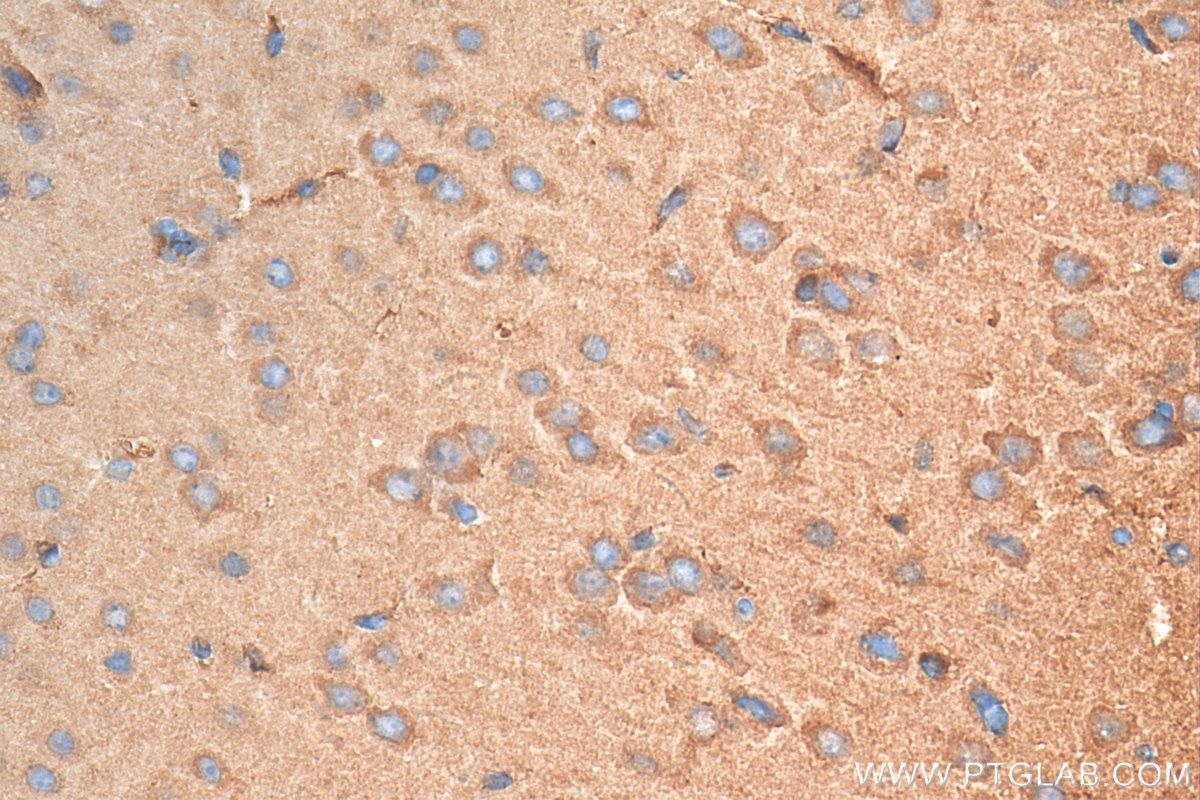 Immunohistochemistry (IHC) staining of mouse brain tissue using GPR37/Pael-R Polyclonal antibody (14820-1-AP)