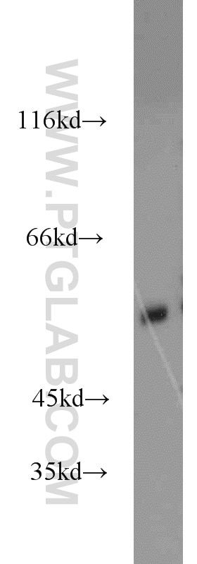 Western Blot (WB) analysis of mouse brain tissue using GPR37/Pael-R Polyclonal antibody (14820-1-AP)
