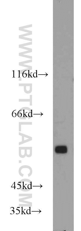 Western Blot (WB) analysis of mouse brain tissue using GPR37/Pael-R Polyclonal antibody (14820-1-AP)