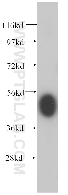 Western Blot (WB) analysis of mouse brain tissue using GPR37/Pael-R Polyclonal antibody (14820-1-AP)