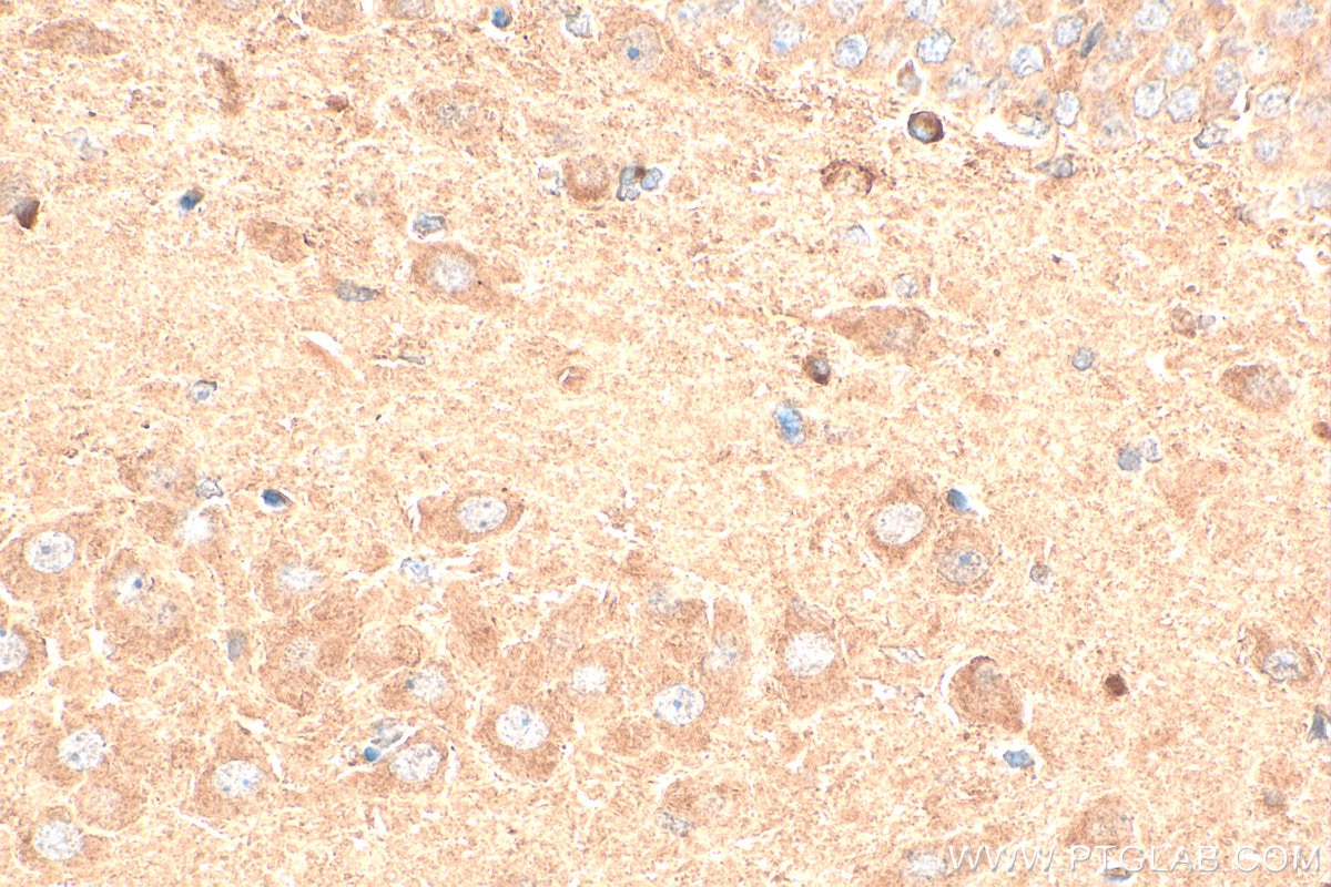 Immunohistochemistry (IHC) staining of rat brain tissue using GPR37/Pael-R Polyclonal antibody (29989-1-AP)