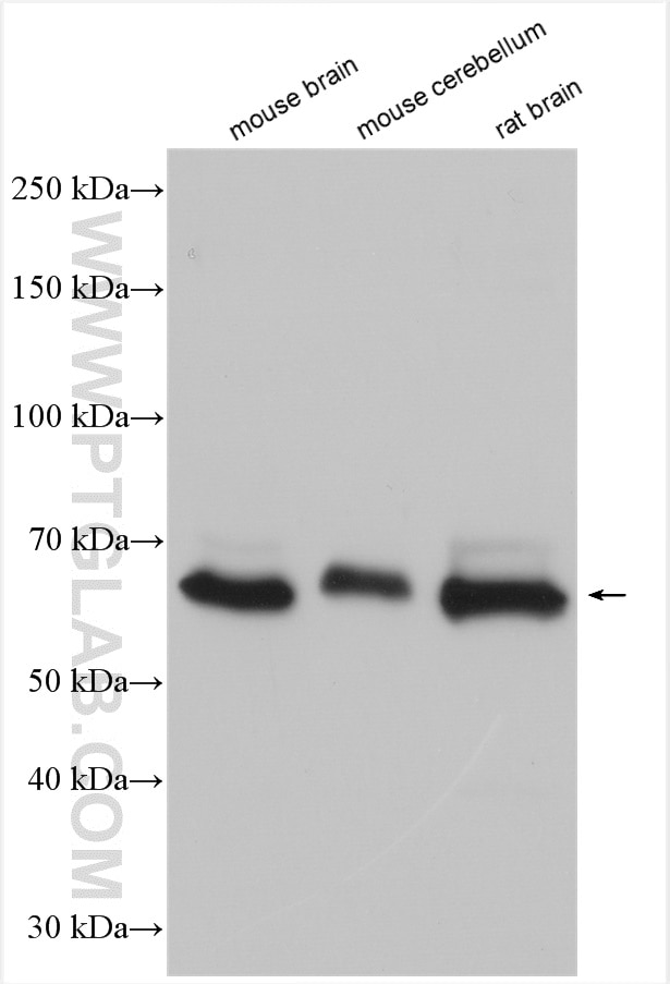 Western Blot (WB) analysis of various lysates using GPR37 Polyclonal antibody (29989-1-AP)