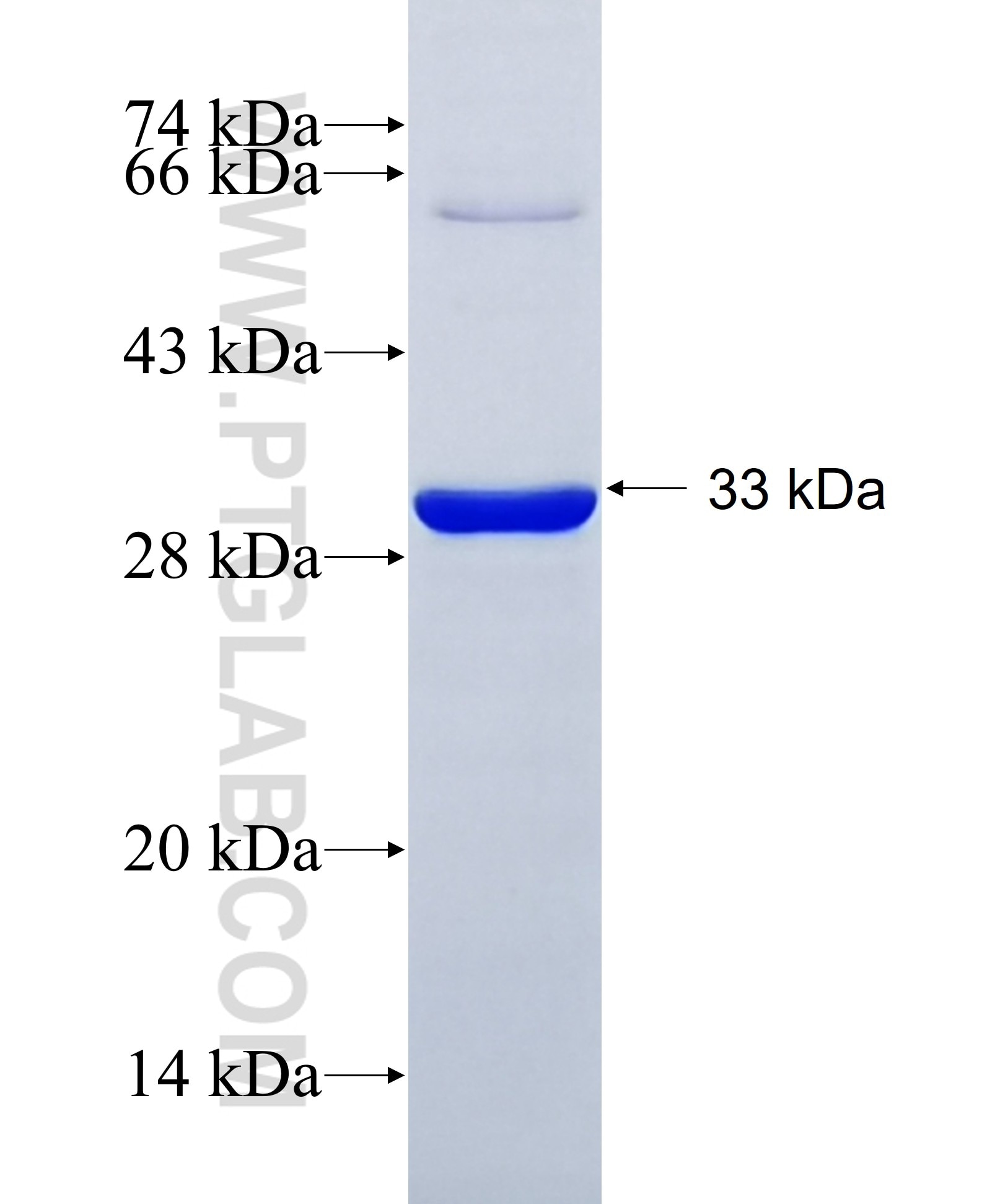 GPR37 fusion protein Ag30386 SDS-PAGE GPR37 fusion protein Ag30386 SDS-PAGE