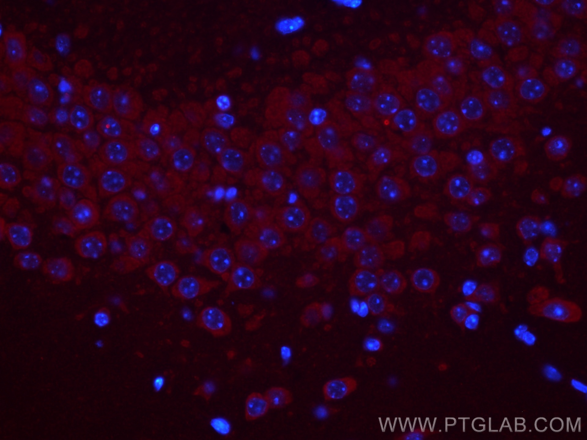 Immunofluorescence (IF) / fluorescent staining of mouse brain tissue using CoraLite®594-conjugated GPR37/Pael-R Polyclonal an (CL594-14820)
