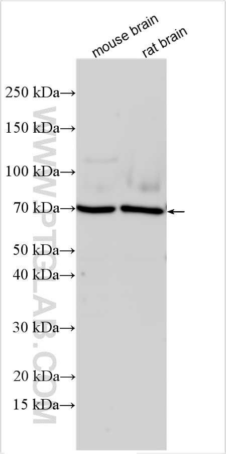 WB analysis using 33358-1-AP Western Blot (WB) analysis of various lysates using GPR37L1 Polyclonal antibody (33358-1-AP)