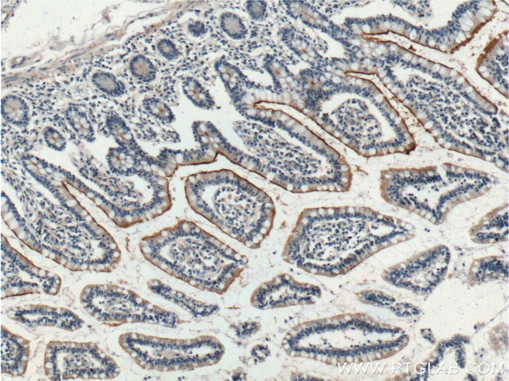 Immunohistochemistry (IHC) staining of human small intestine tissue using GPR39 Polyclonal antibody (23326-1-AP)