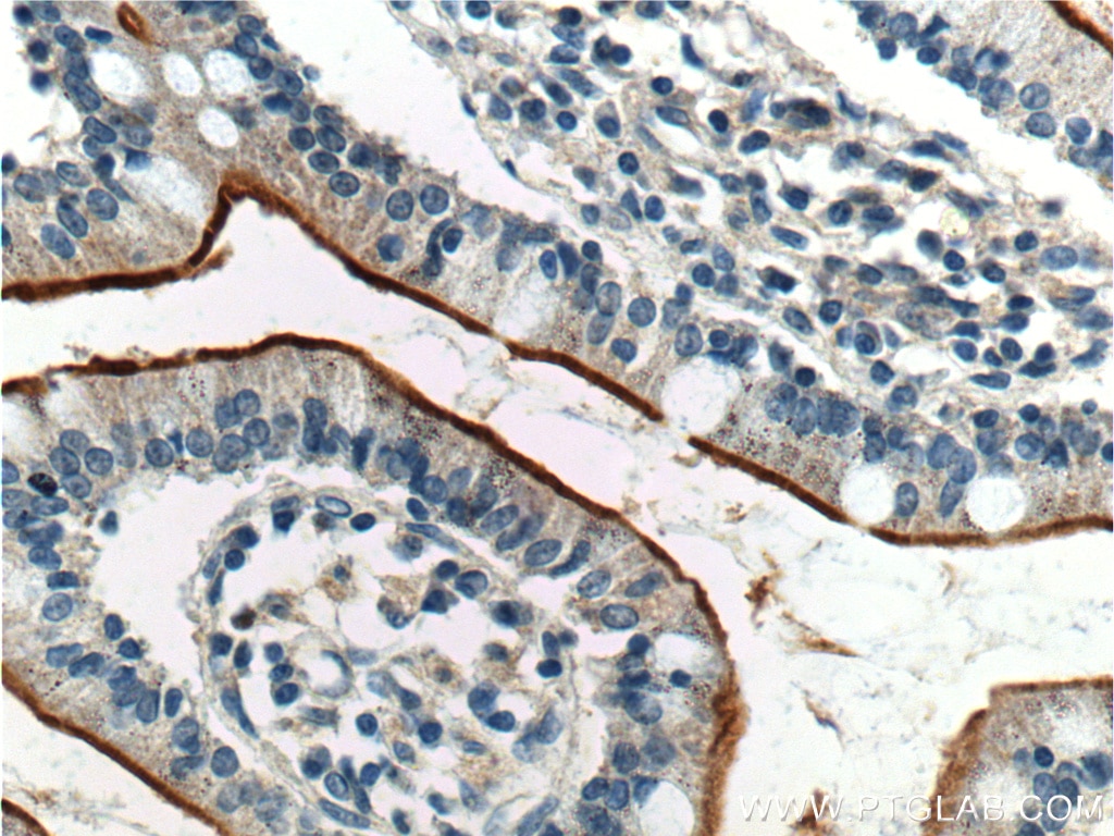 Immunohistochemistry (IHC) staining of human small intestine tissue using GPR39 Polyclonal antibody (23326-1-AP)