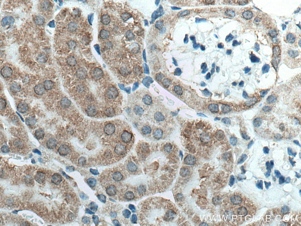 Immunohistochemistry (IHC) staining of mouse kidney tissue using GPR4 Polyclonal antibody (28232-1-AP)